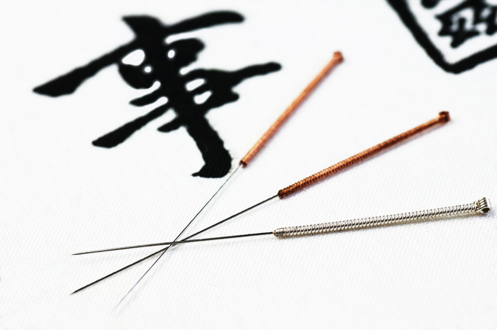 Eastern Medicine to the Rescue – a remedy for true and deep healing 5 acupuncture
